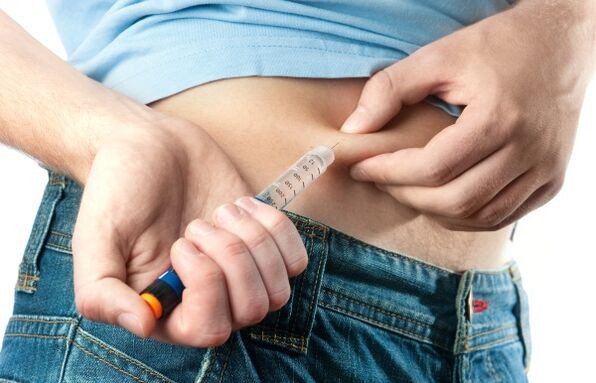 شدید قسم 2 ذیابیطس میں انسولین کی انتظامیہ کی ضرورت ہوتی ہے۔